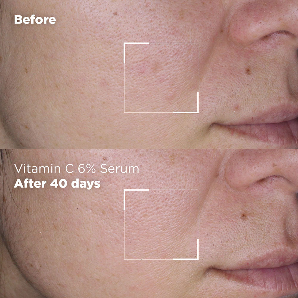 Vitamin C 6% serum