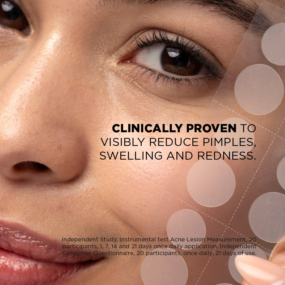 Patch anti-acné Spot Clear avec acide salicylique (48 patchs)