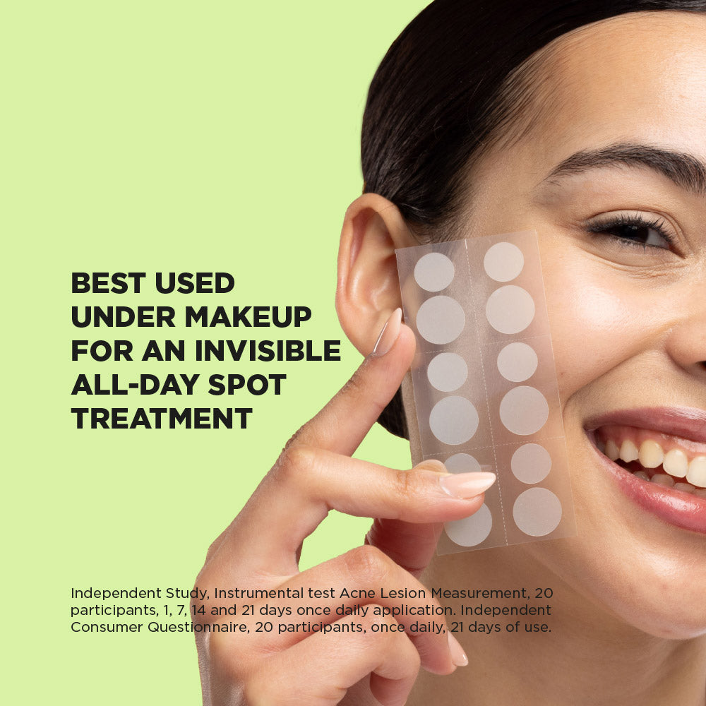 Patch anti-acné Spot Clear avec acide salicylique (48 patchs)