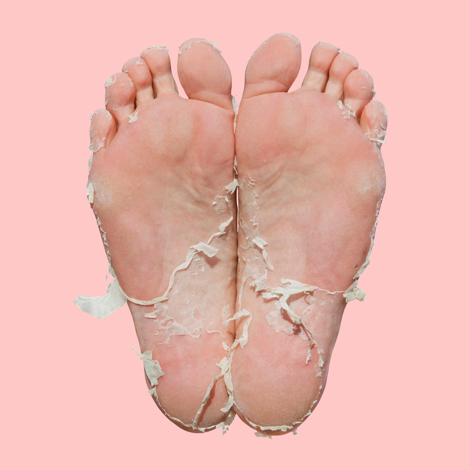 Pedi Peel Max